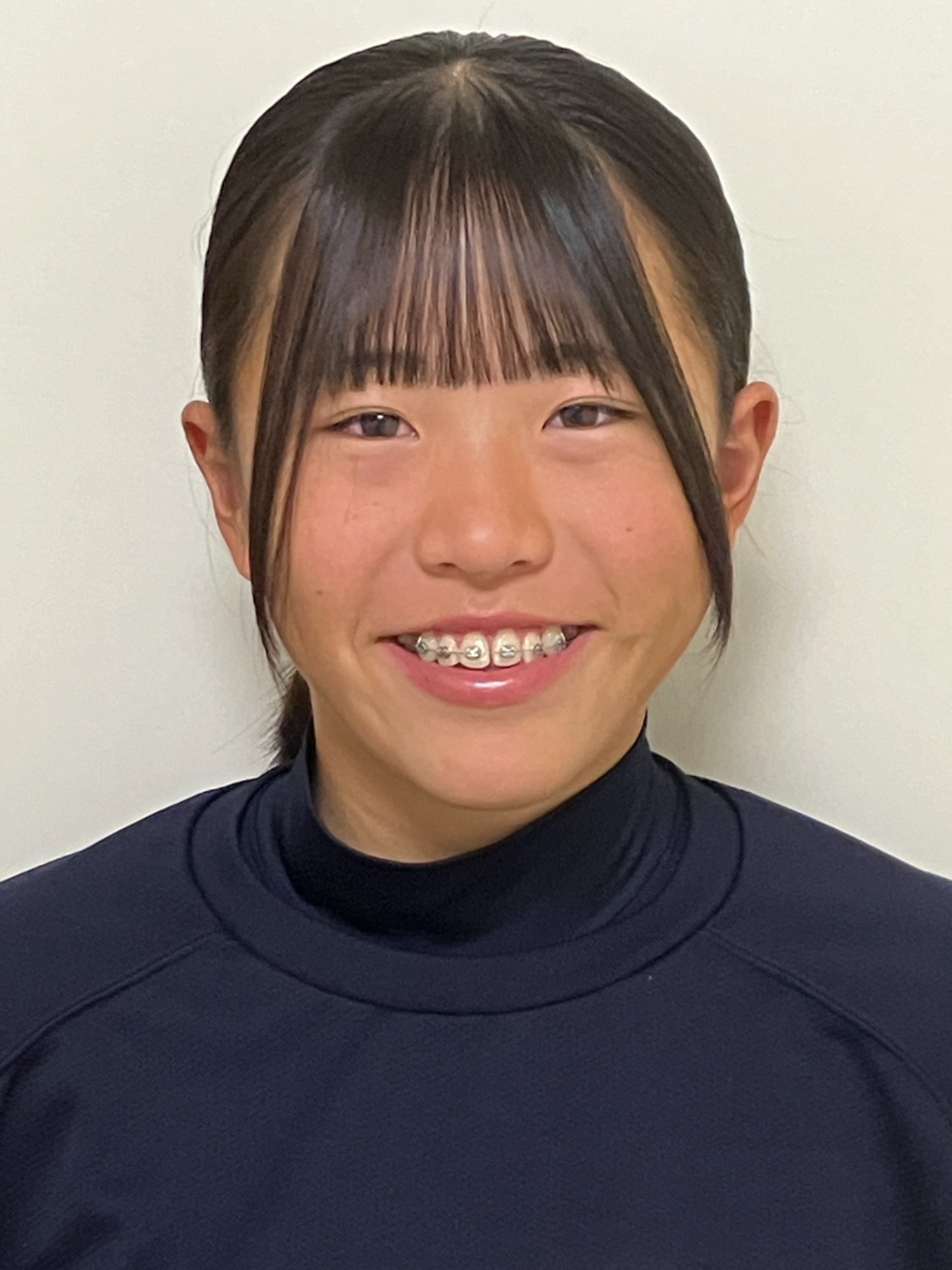 KITAMURA-Haru